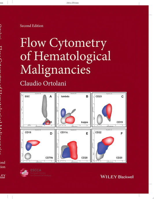 Flow Cytometry of Hematological Malignancies