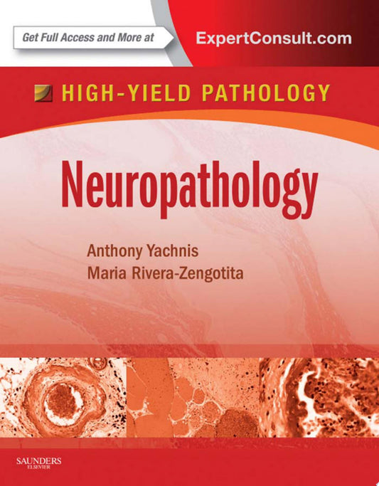 Neuropathology: A Volume in the High Yield Pathology Series