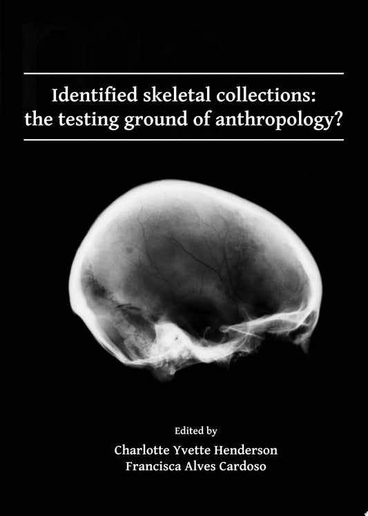 Tuberculosis and the Tubercle Bacillus, 2nd Edition