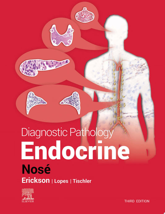 Diagnostic Pathology: Endocrine, 2nd Edition