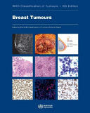 WHO Classification of Tumours of the Breast
