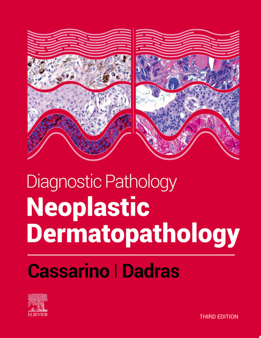 Diagnostic Pathology: Neoplastic Dermatopathology, 2nd Edition