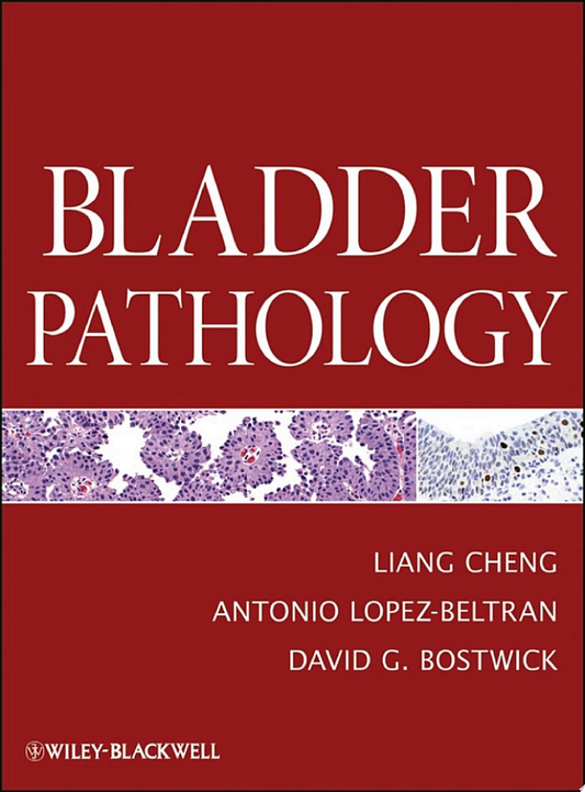 Bladder Pathology, 2nd edition