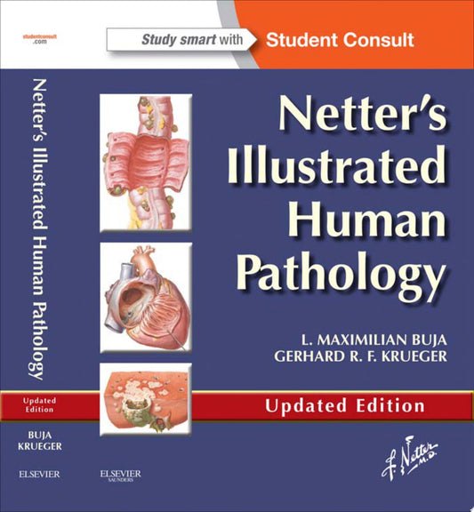 Netter’s Illustrated Human Pathology Updated Edition