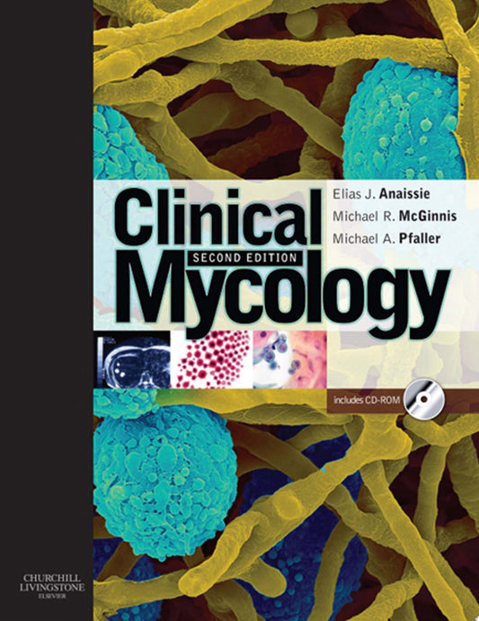 Clinical Mycology, 2nd Edition