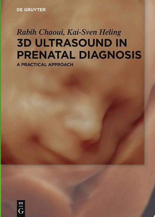 3D Ultrasound in Prenatal Diagnosis: A Practical Approach, 2nd Edition