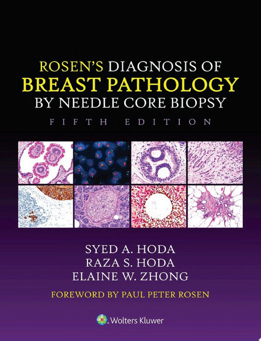 Breast Pathology: Diagnosis by Needle Core Biopsy, 3rd Edition