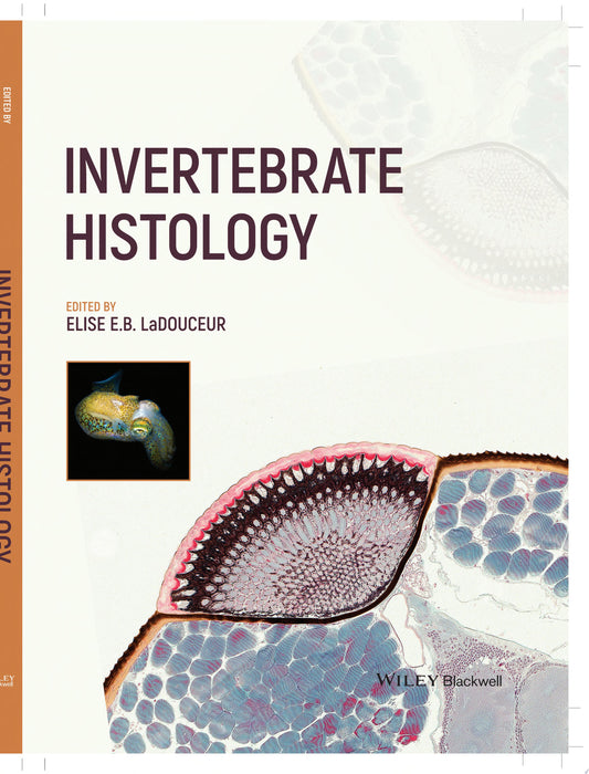 Microbiology: The Human Experience, 2nd Edition